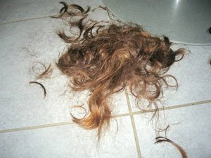 La loción de la alopecia